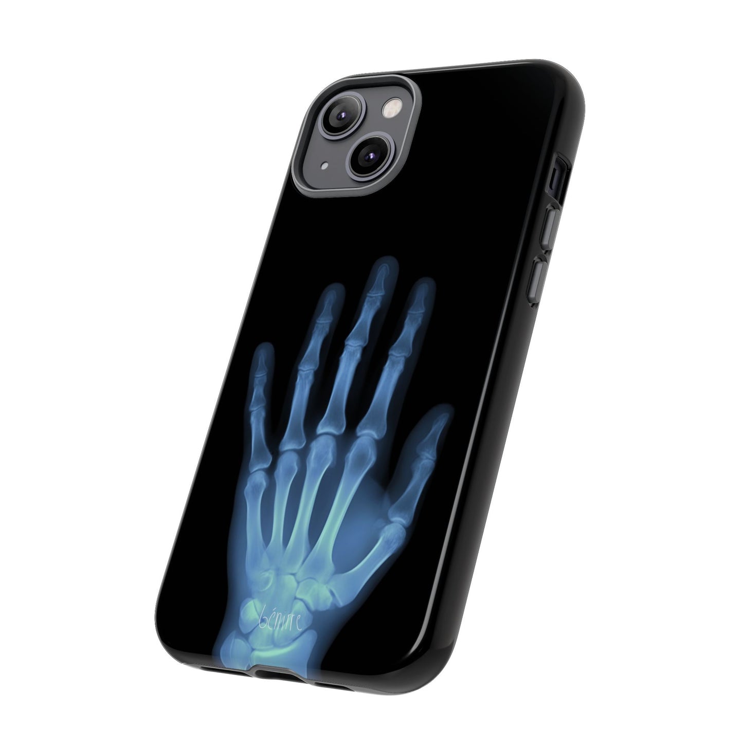The Radiograph Tough Case