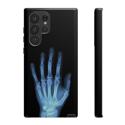 The Radiograph Tough Case