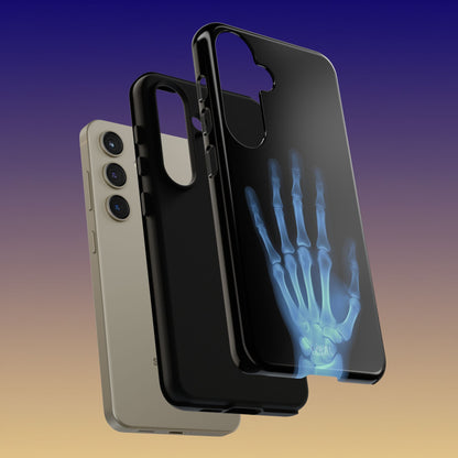 The Radiograph Tough Case