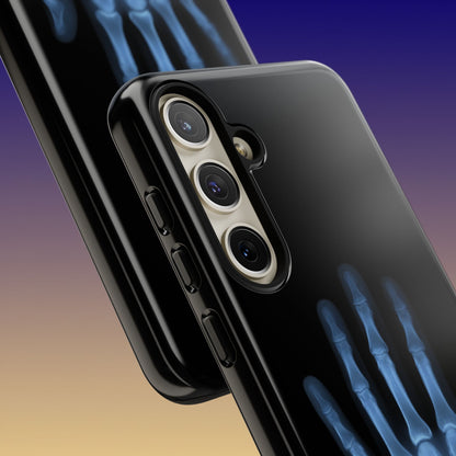 The Radiograph Tough Case