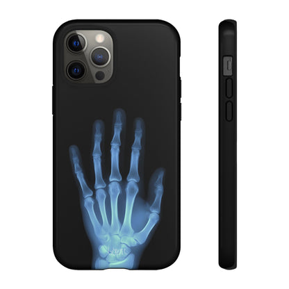 The Radiograph Tough Case