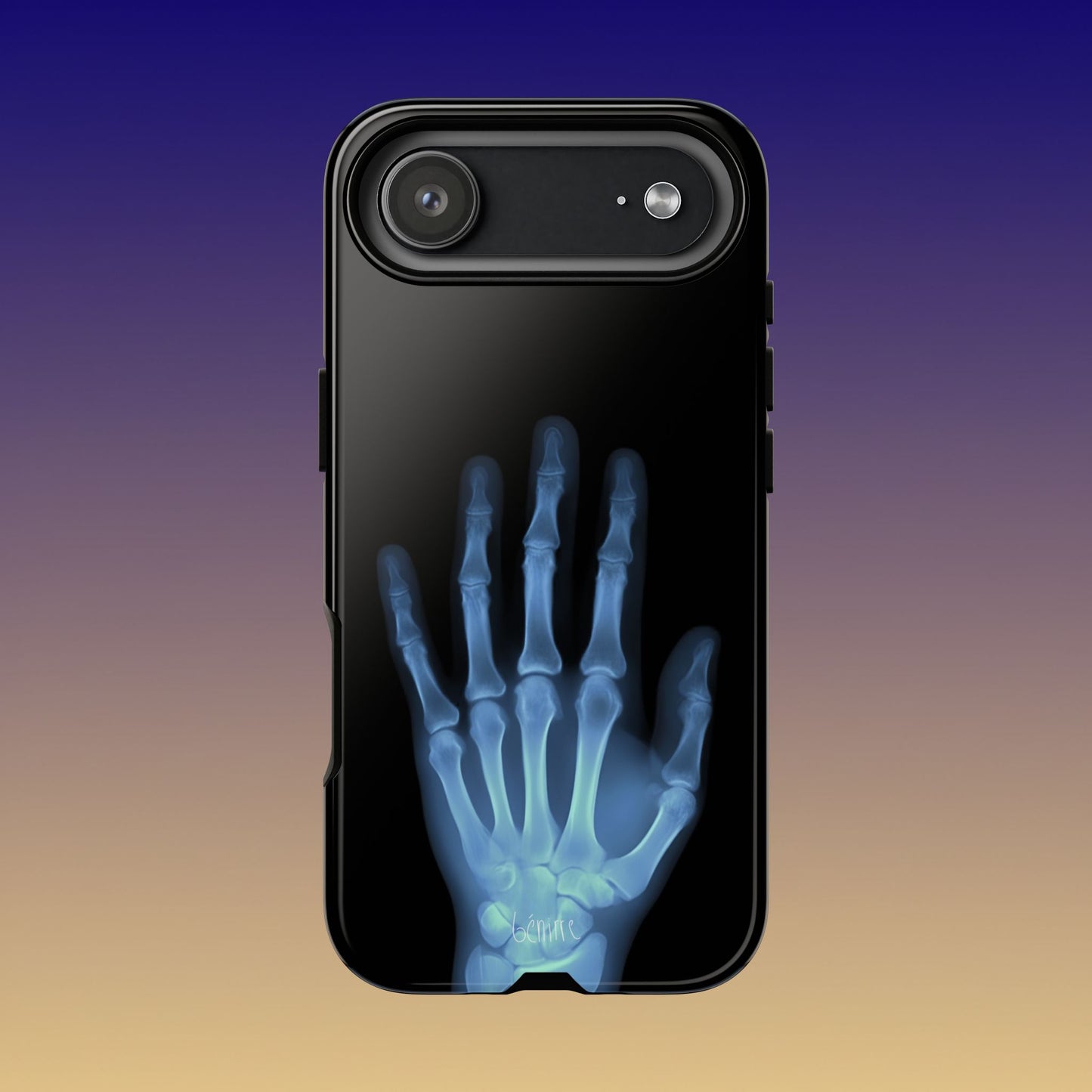 The Radiograph Tough Case