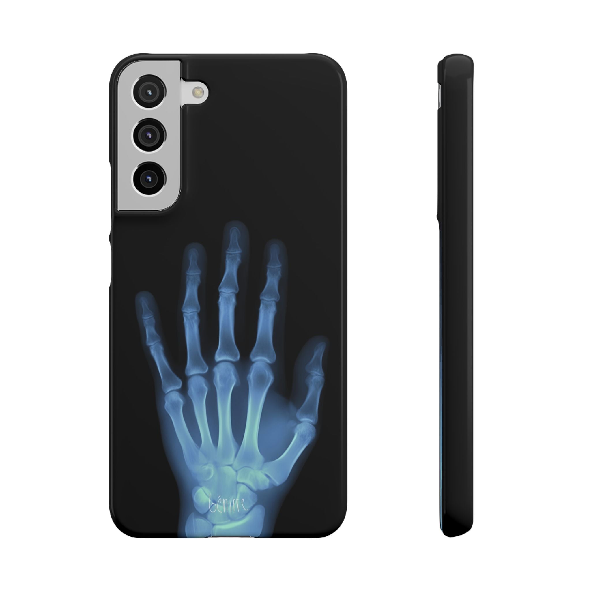 レントゲンライト