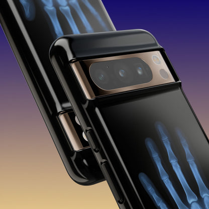 The Radiograph Tough Case