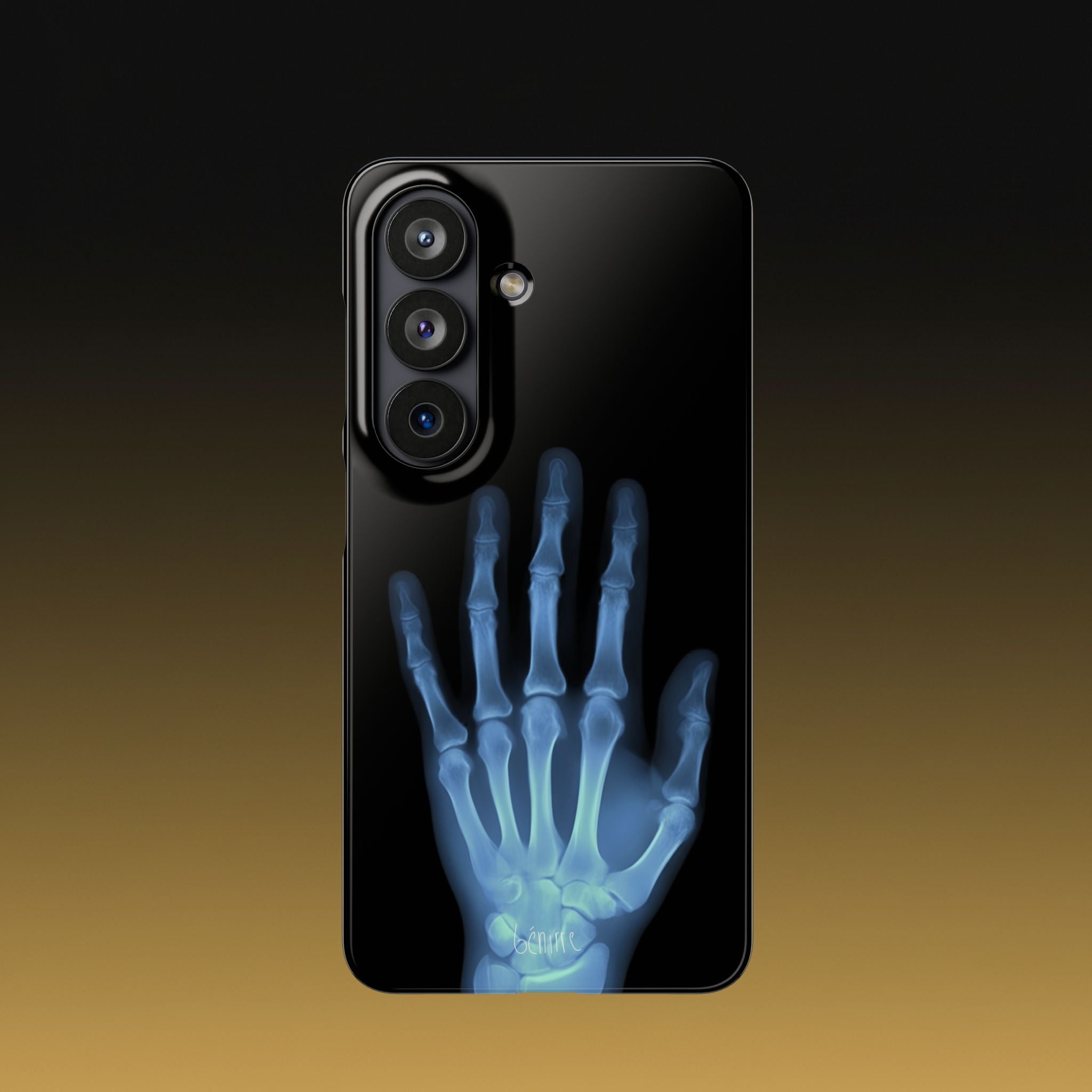 レントゲンライト