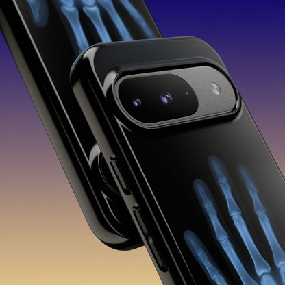 The Radiograph Tough Case