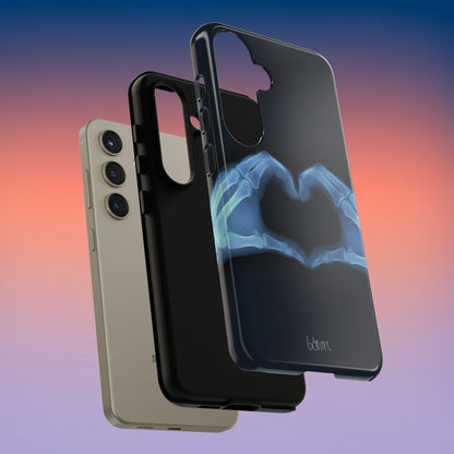 Bone Deep Tough Case