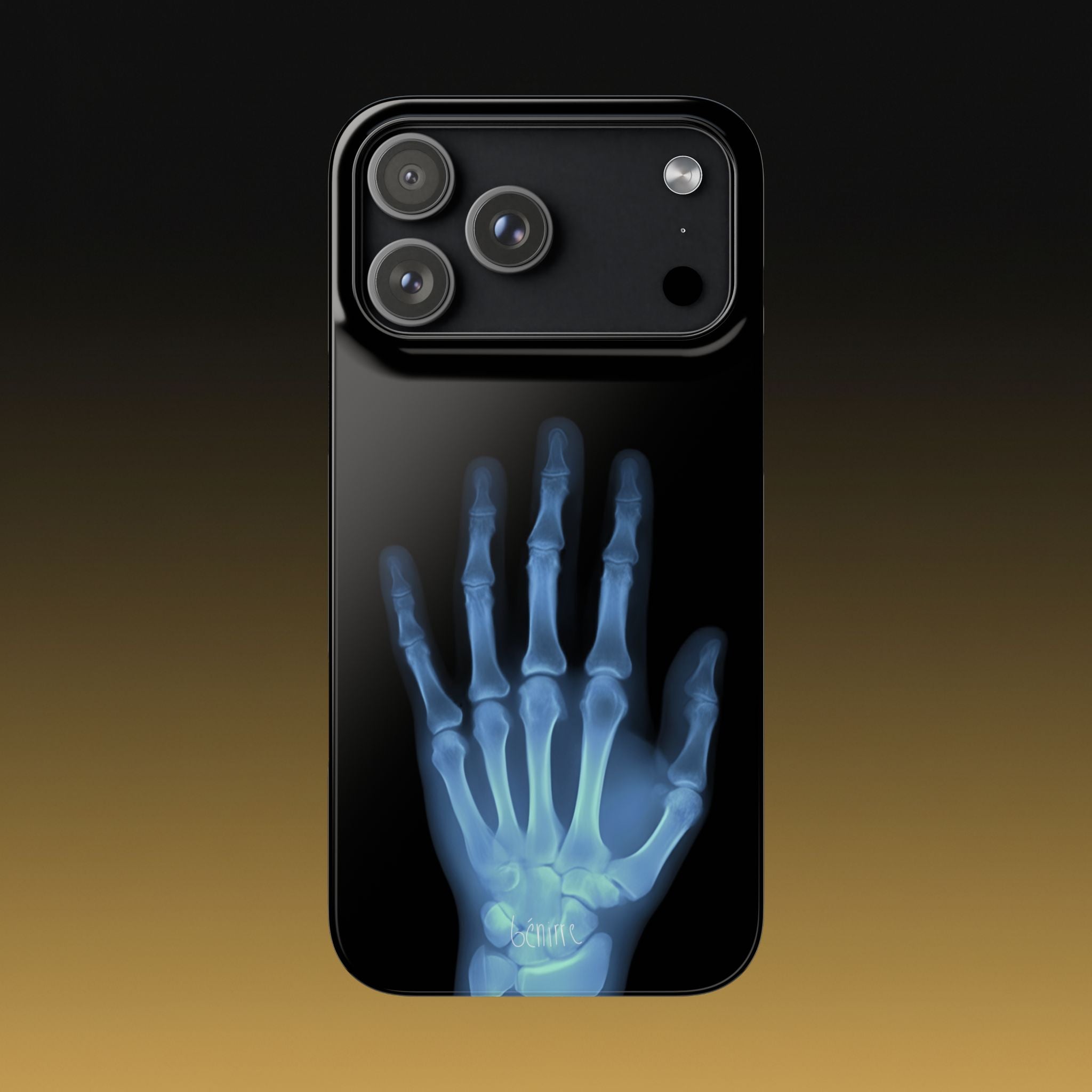 レントゲンライト