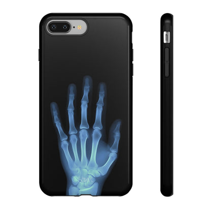 The Radiograph Tough Case