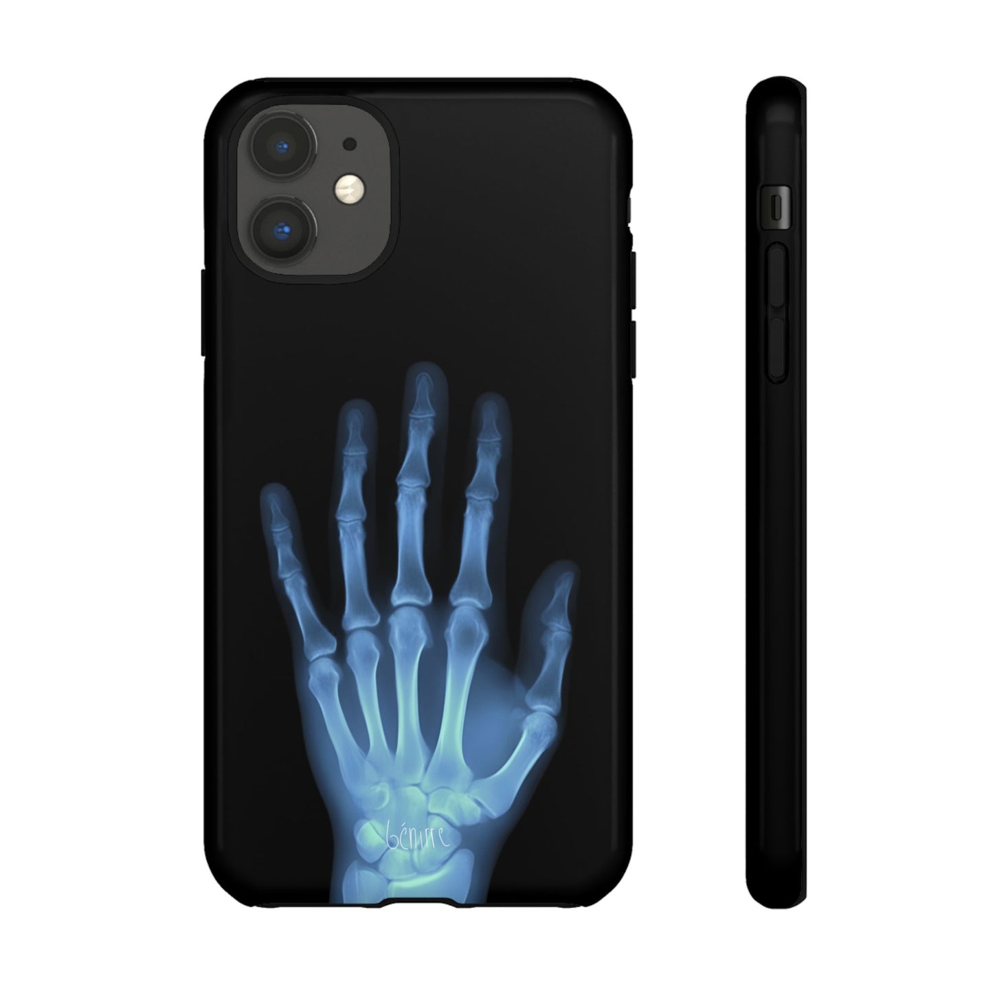 The Radiograph Tough Case