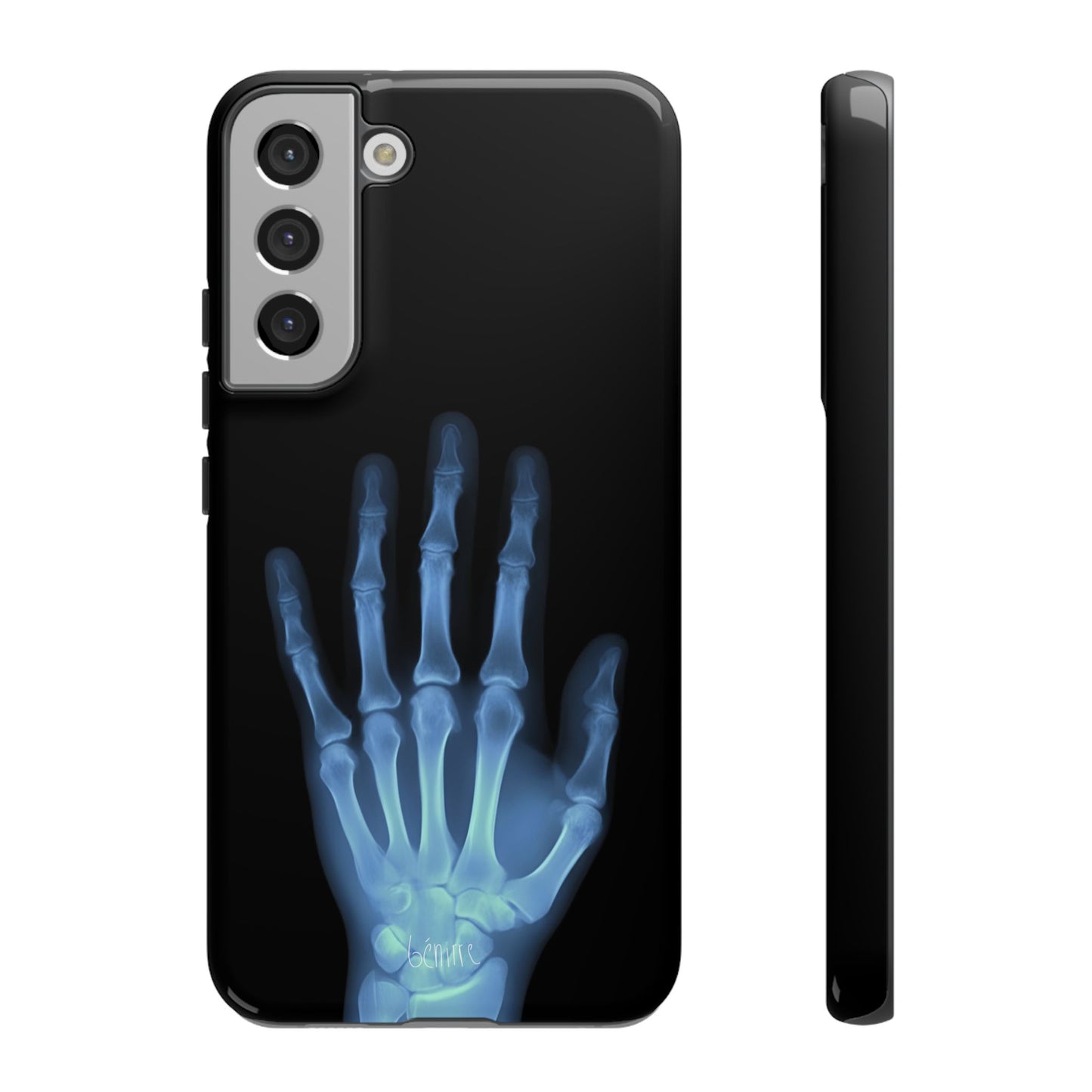 The Radiograph Tough Case