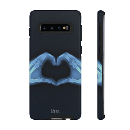 Bone Deep Tough Case