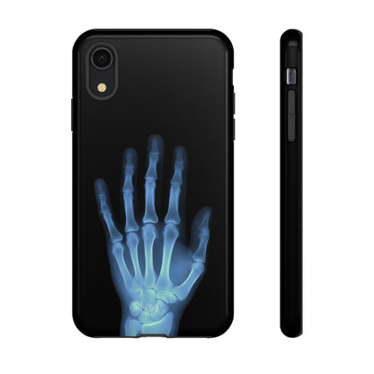 The Radiograph Tough Case