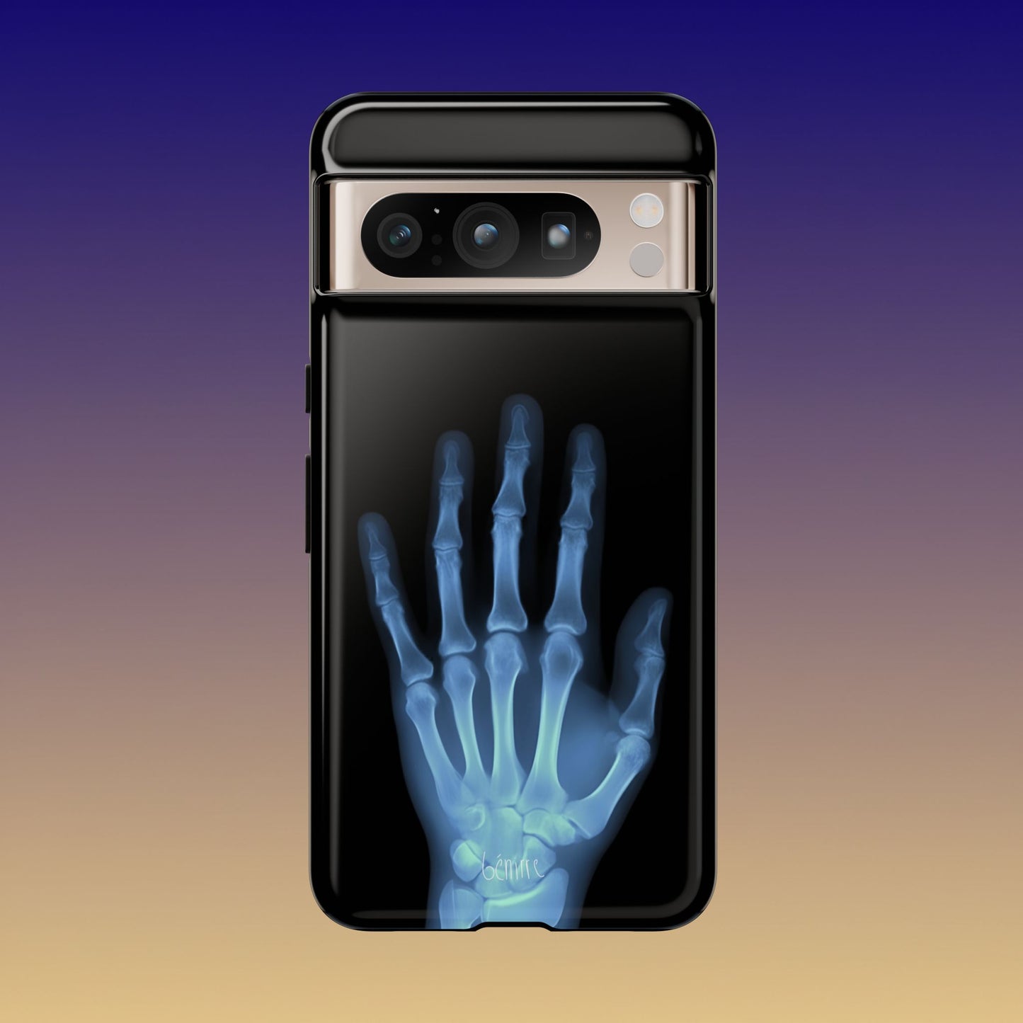 The Radiograph Tough Case