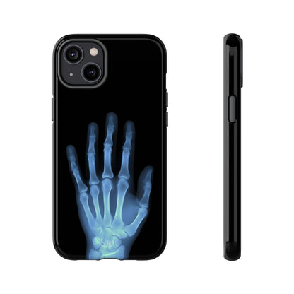 The Radiograph Tough Case