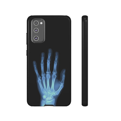 The Radiograph Tough Case