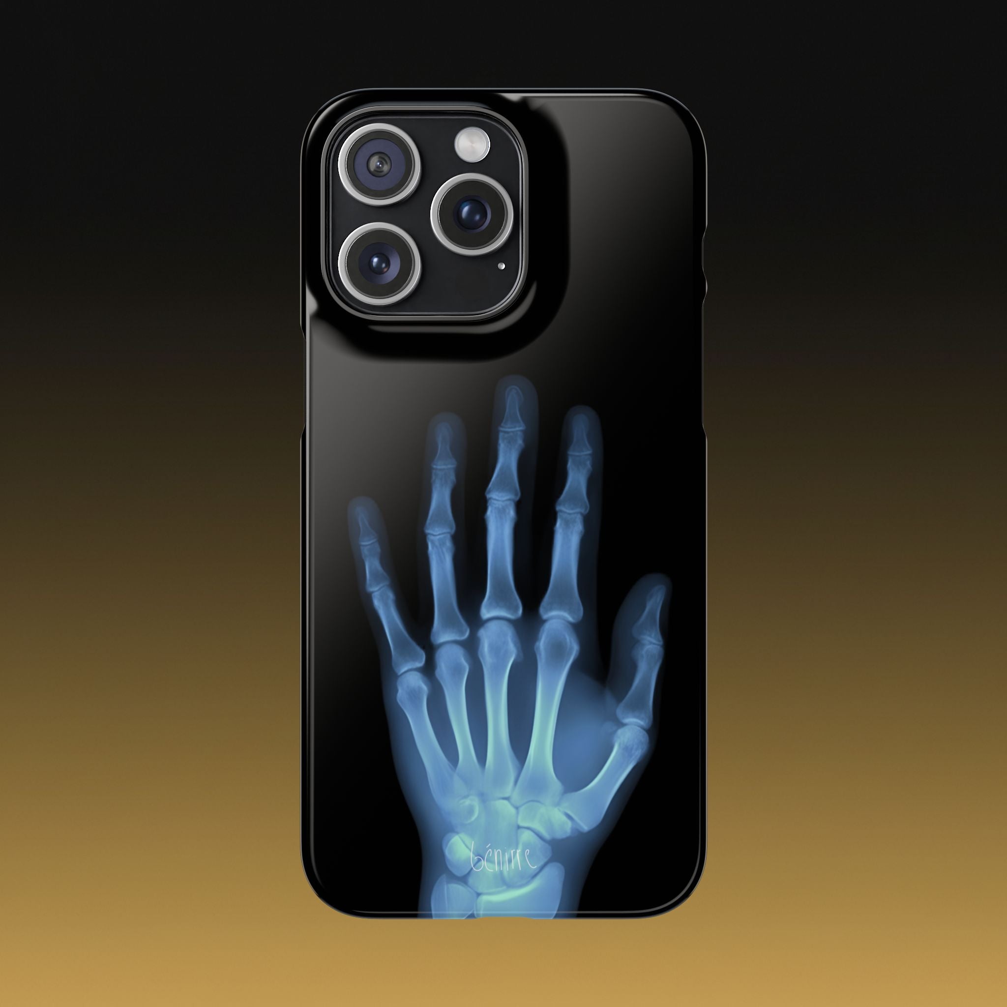 レントゲンライト