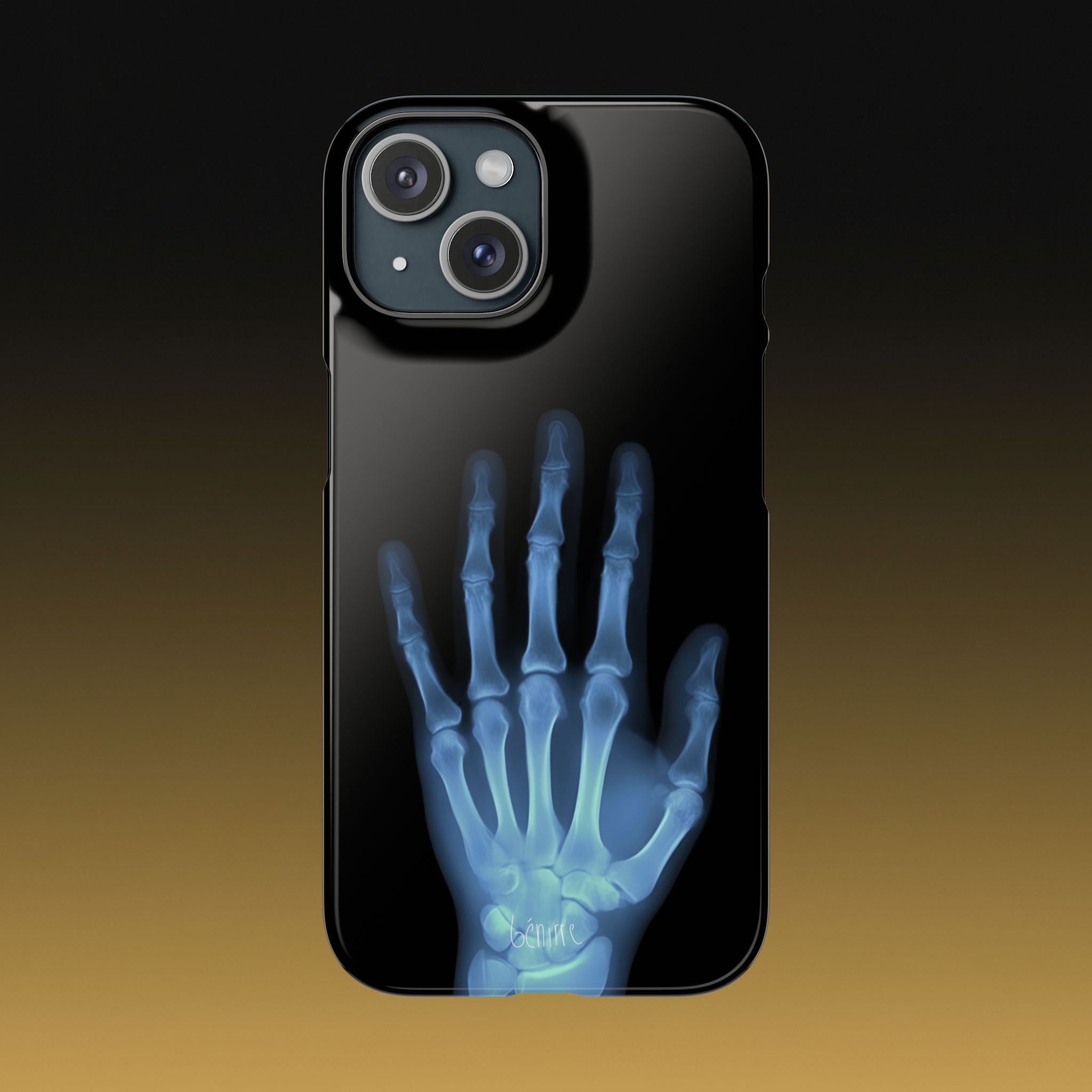 レントゲンライト