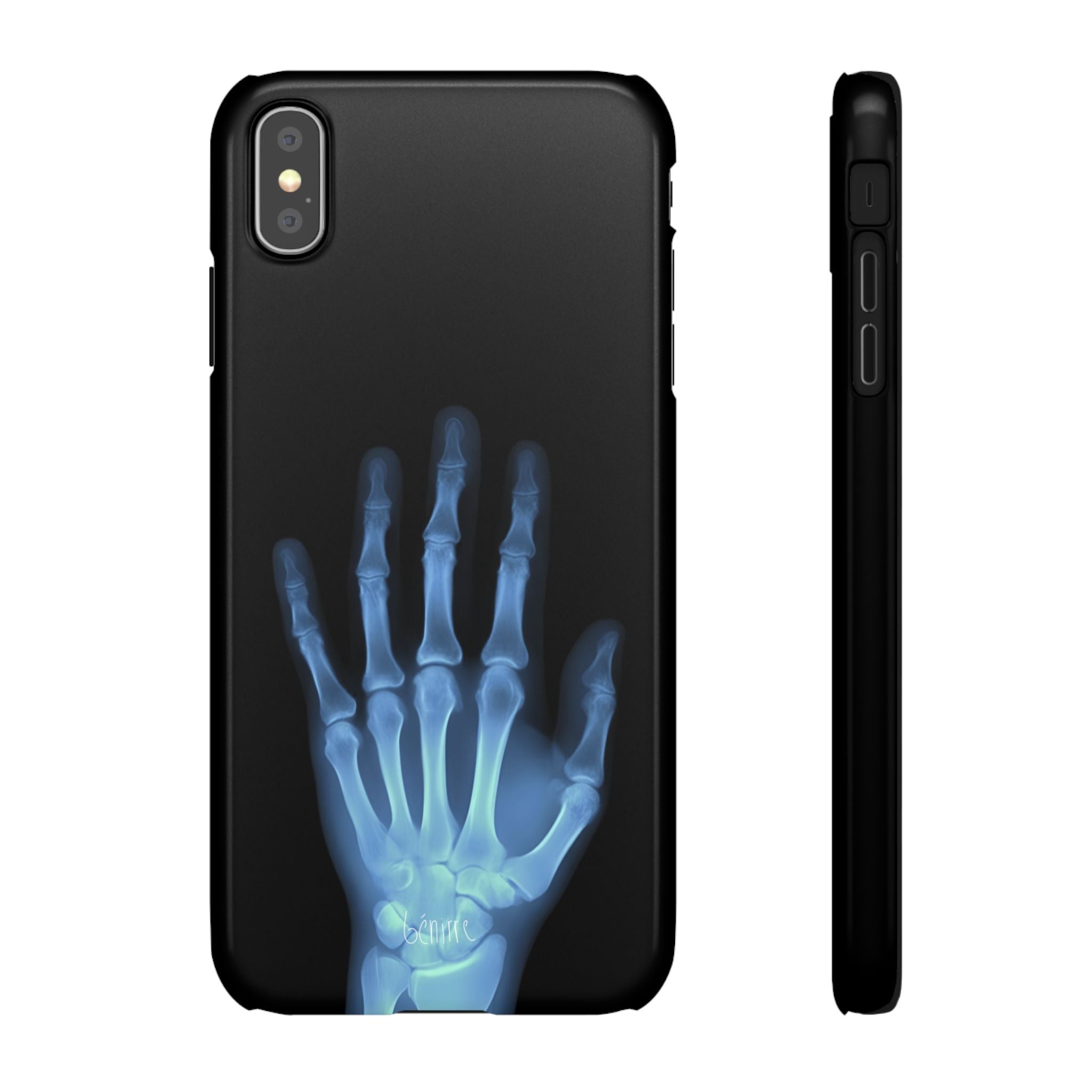 レントゲンライト