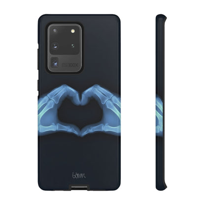 Bone Deep Tough Case