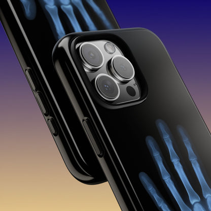 The Radiograph Tough Case