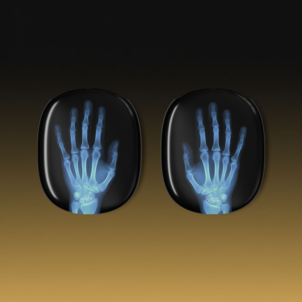 The Radiograph AirPods Max Case