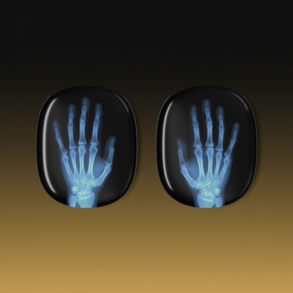 The Radiograph AirPods Max Case