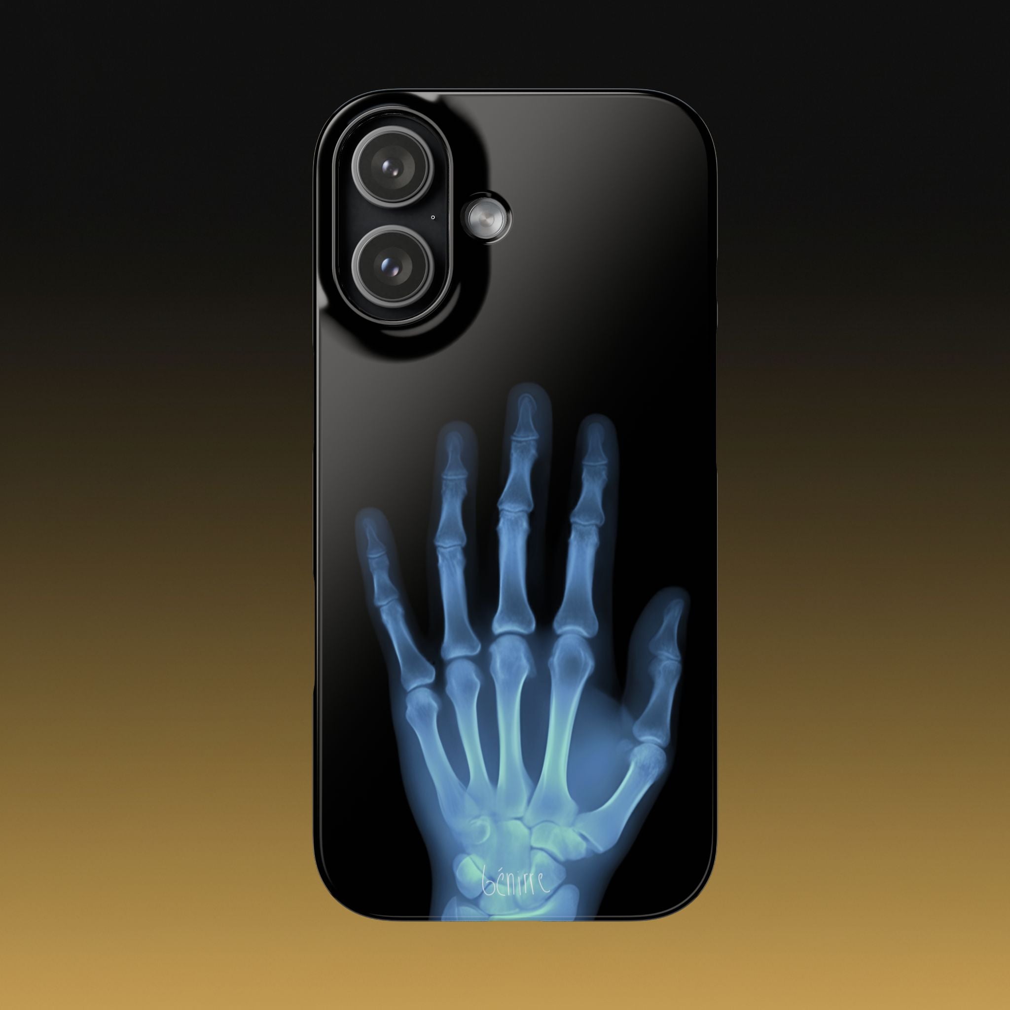 レントゲンライト