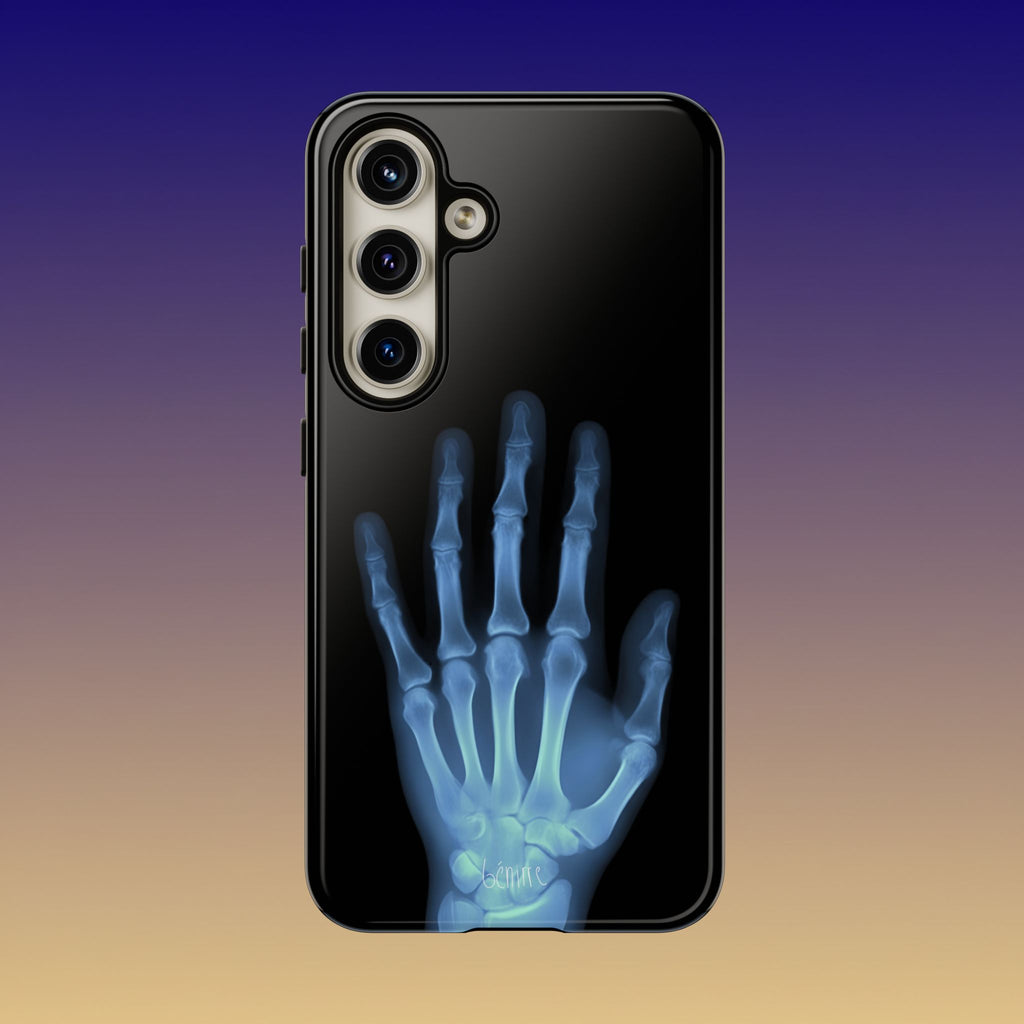 レントゲン写真