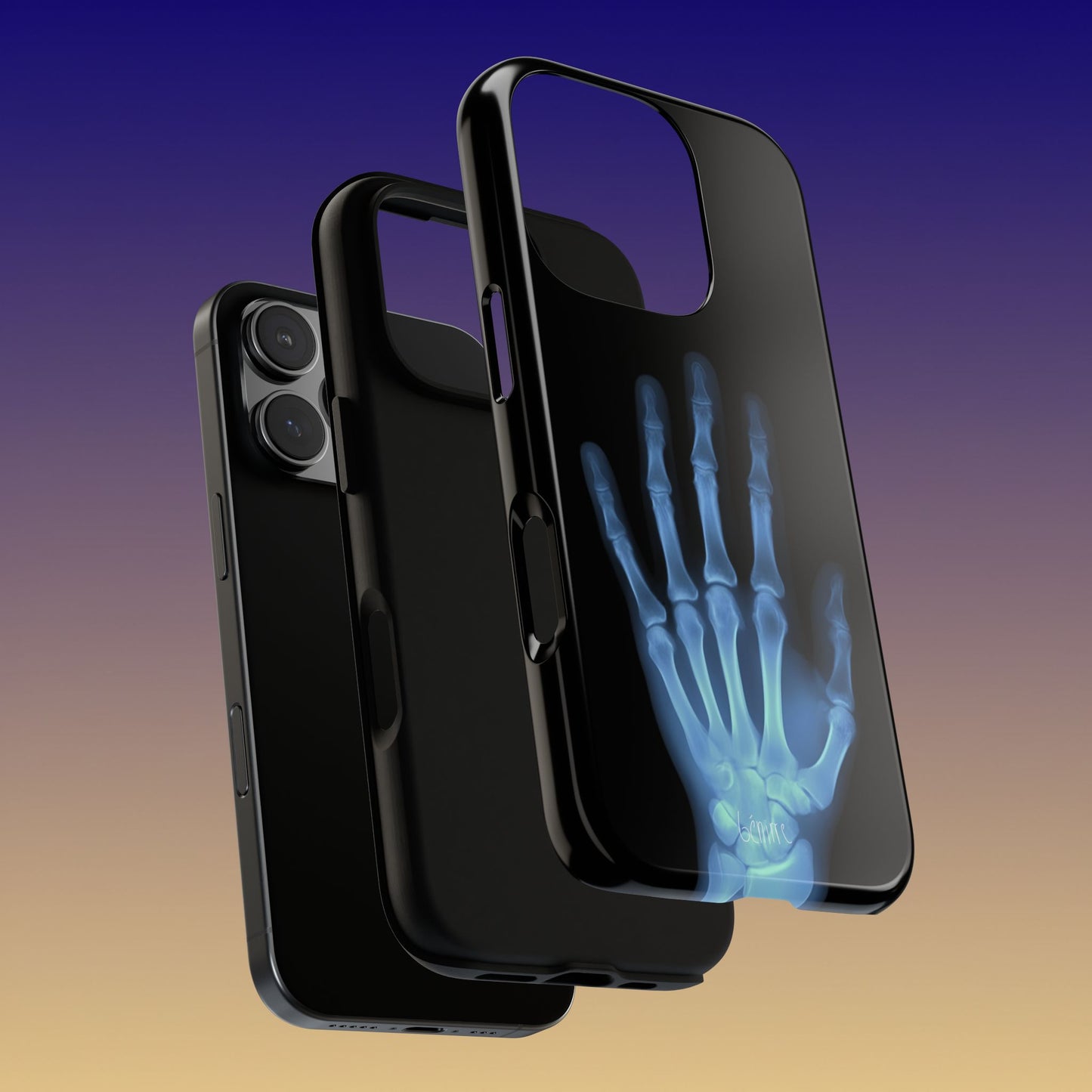 The Radiograph Tough Case