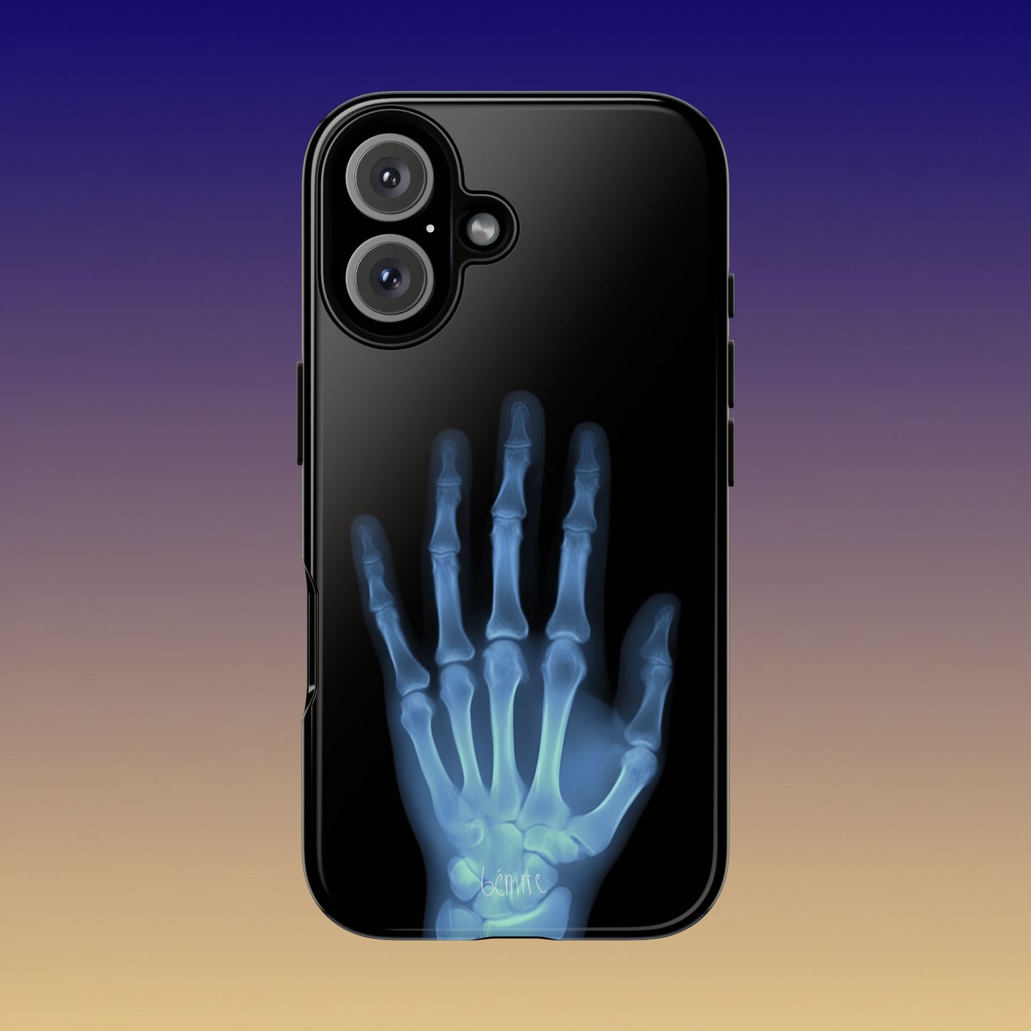 The Radiograph Tough Case