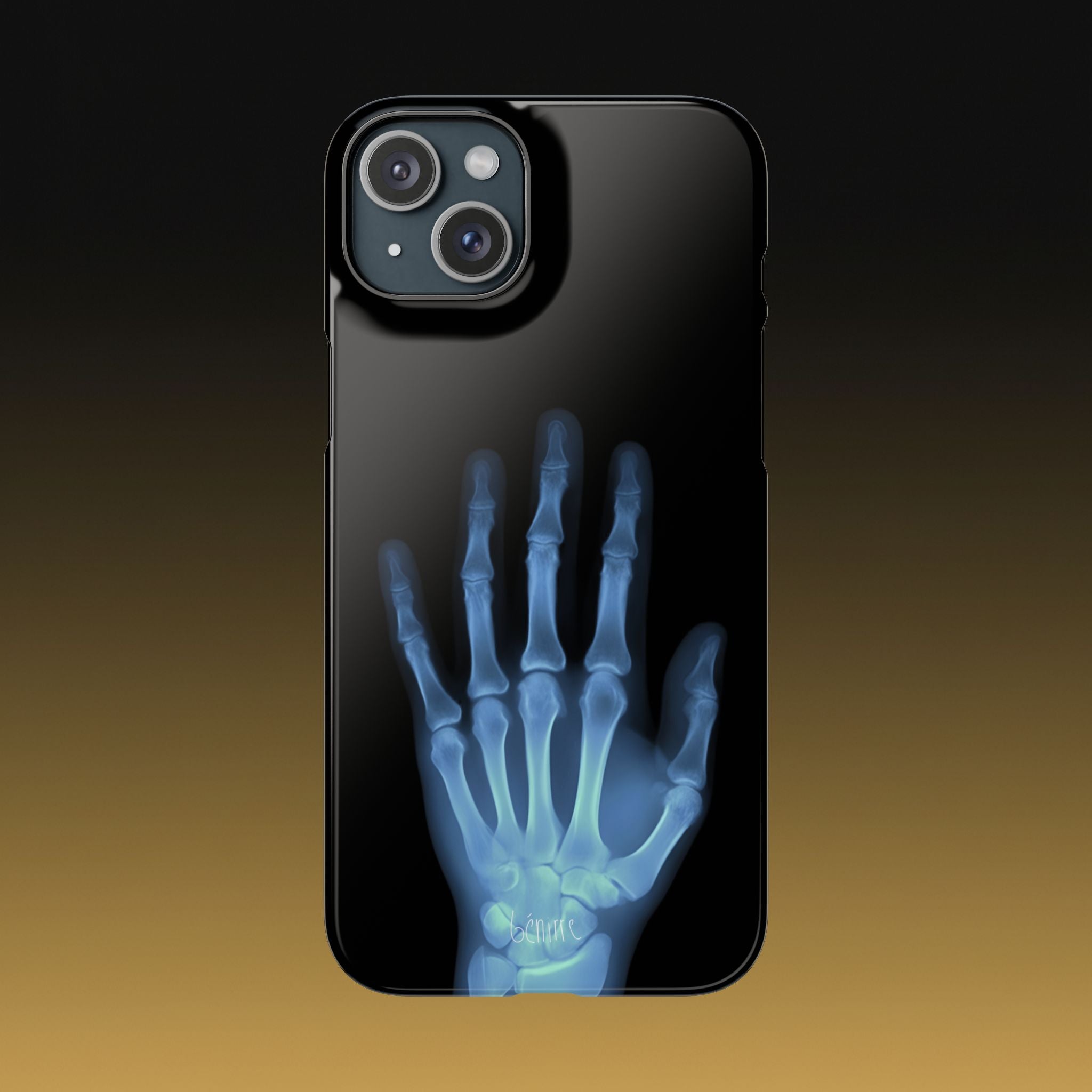 レントゲンライト