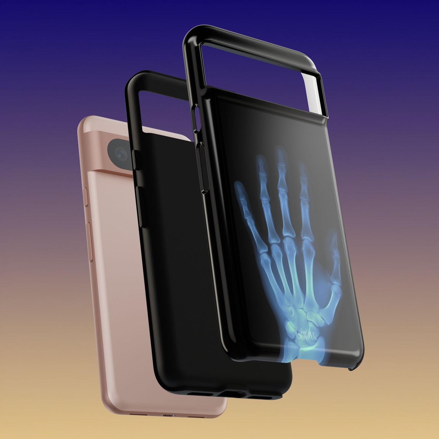 The Radiograph Tough Case