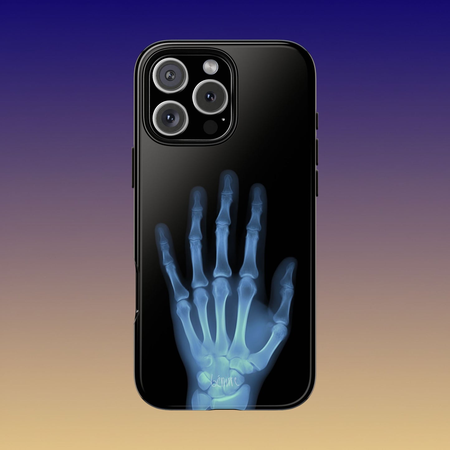 The Radiograph Tough Case