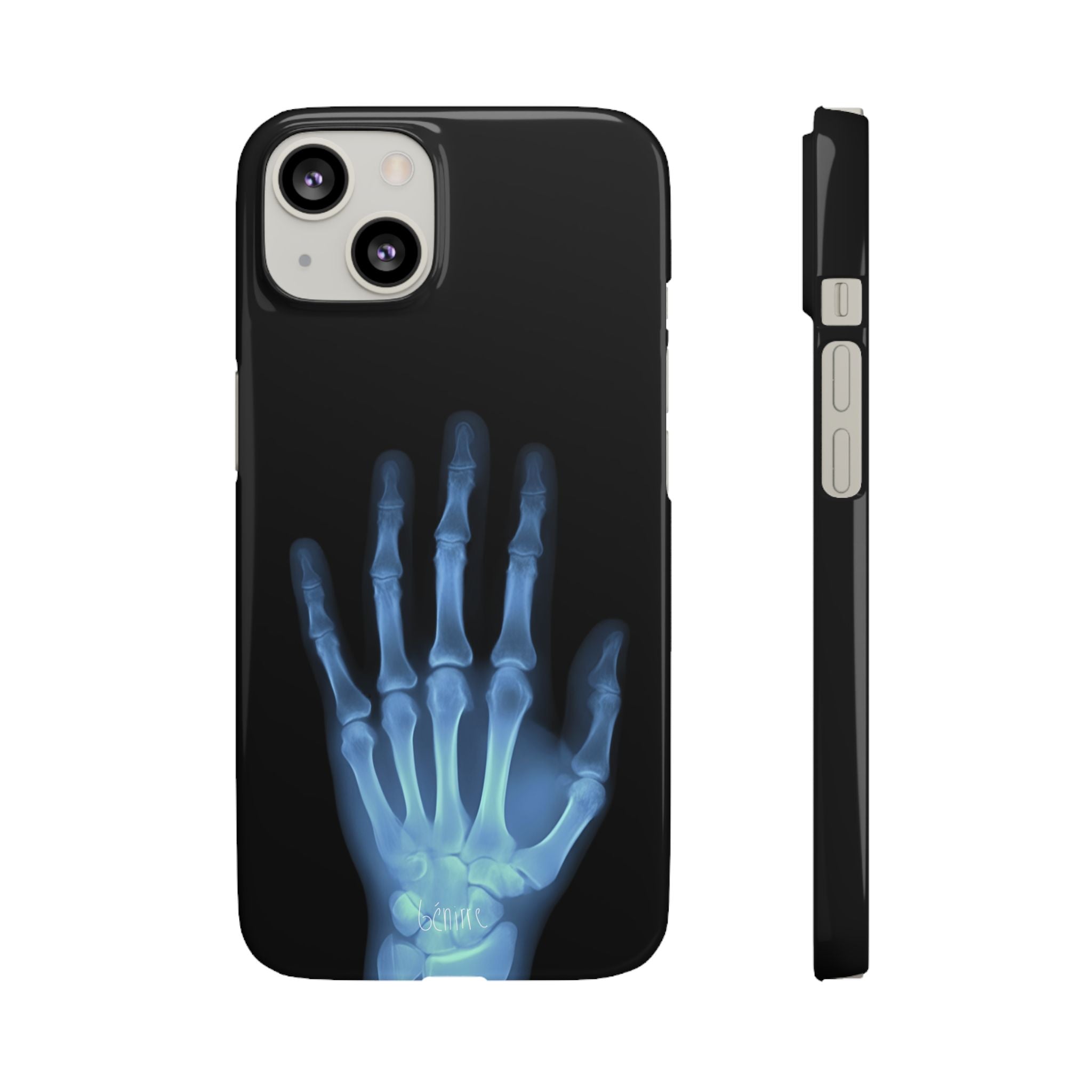 レントゲンライト