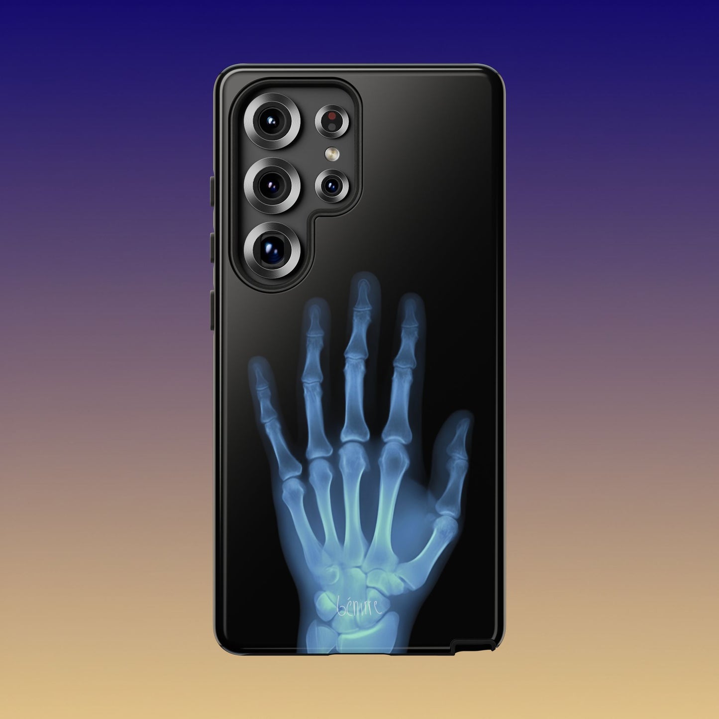 The Radiograph Tough Case