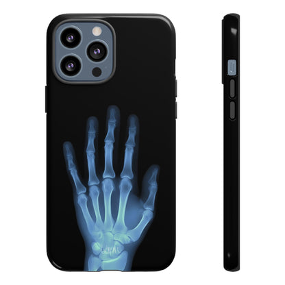 The Radiograph Tough Case