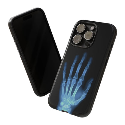 The Radiograph Tough Case