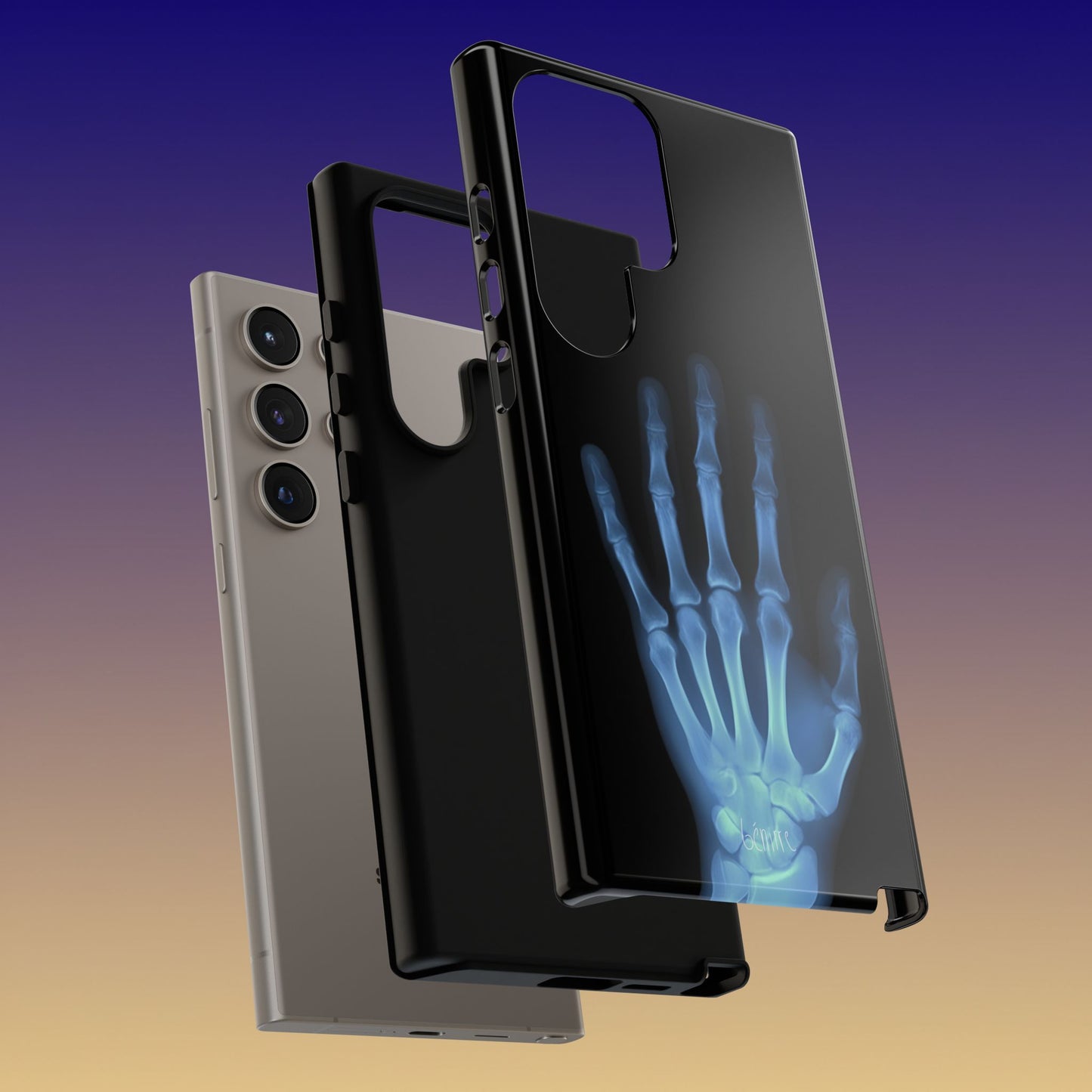 The Radiograph Tough Case