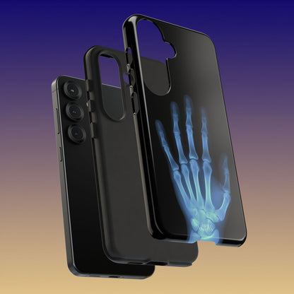 The Radiograph Tough Case
