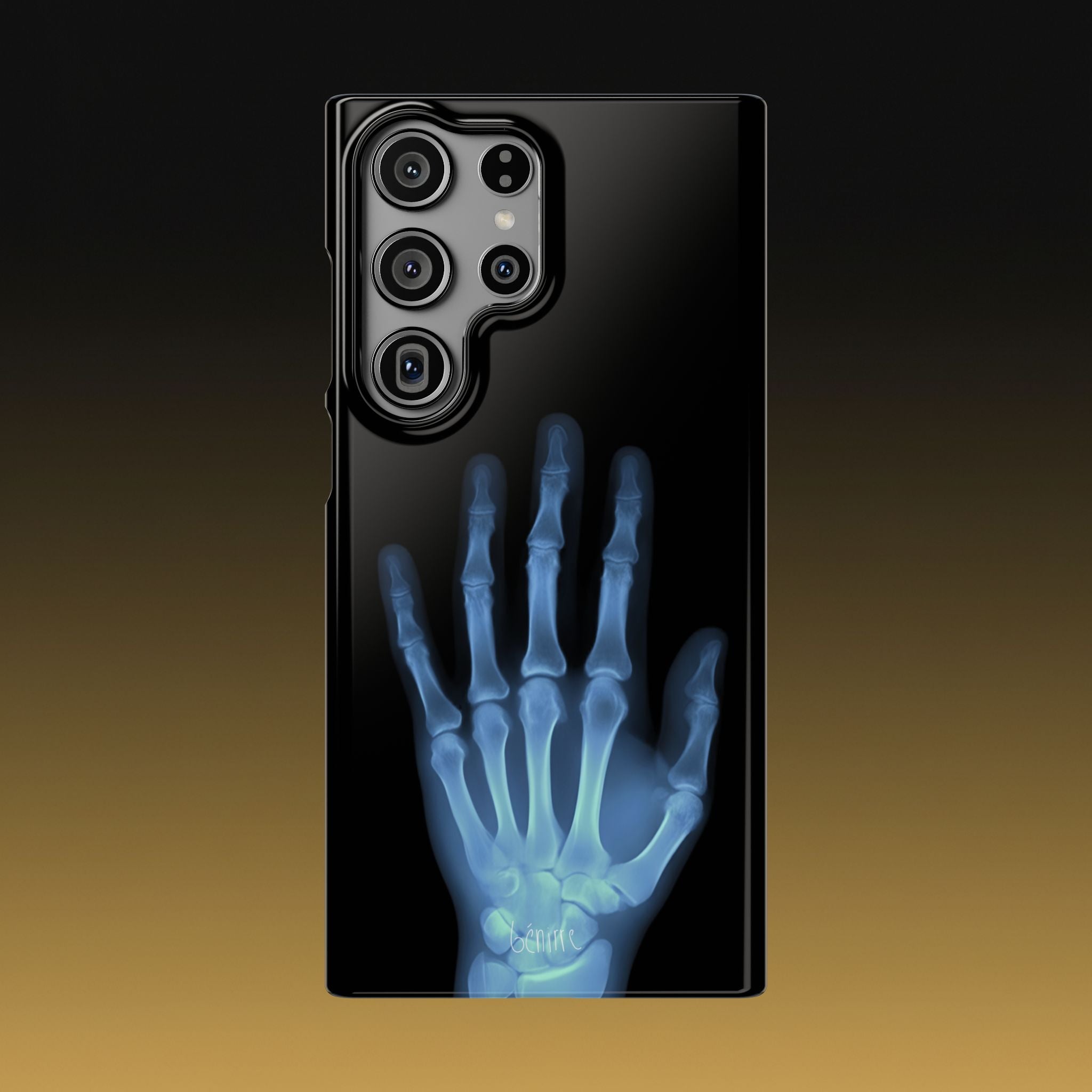 レントゲンライト