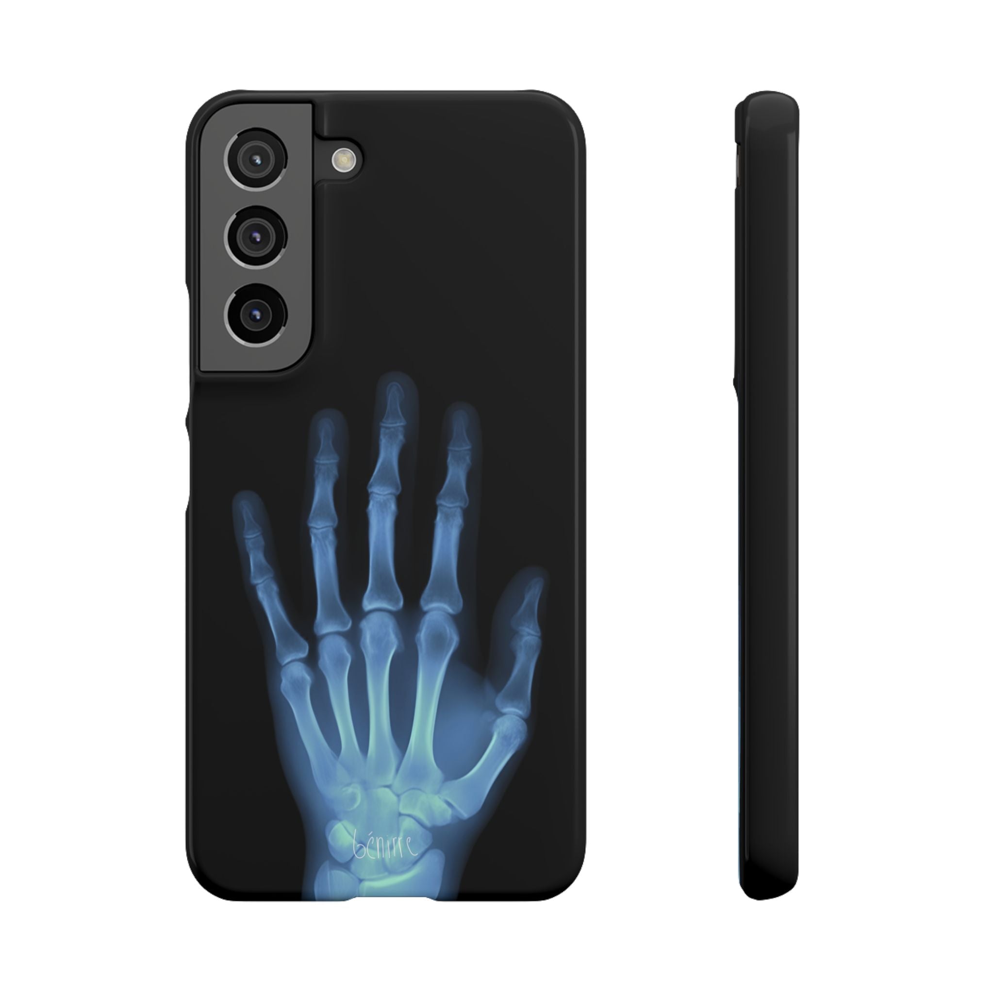 レントゲンライト