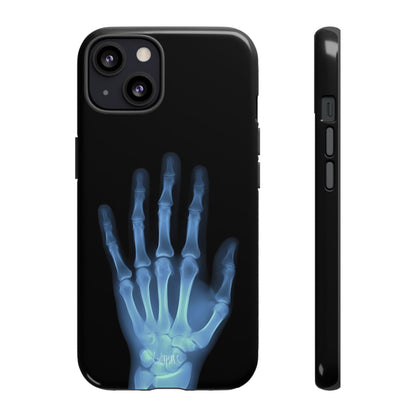 The Radiograph Tough Case