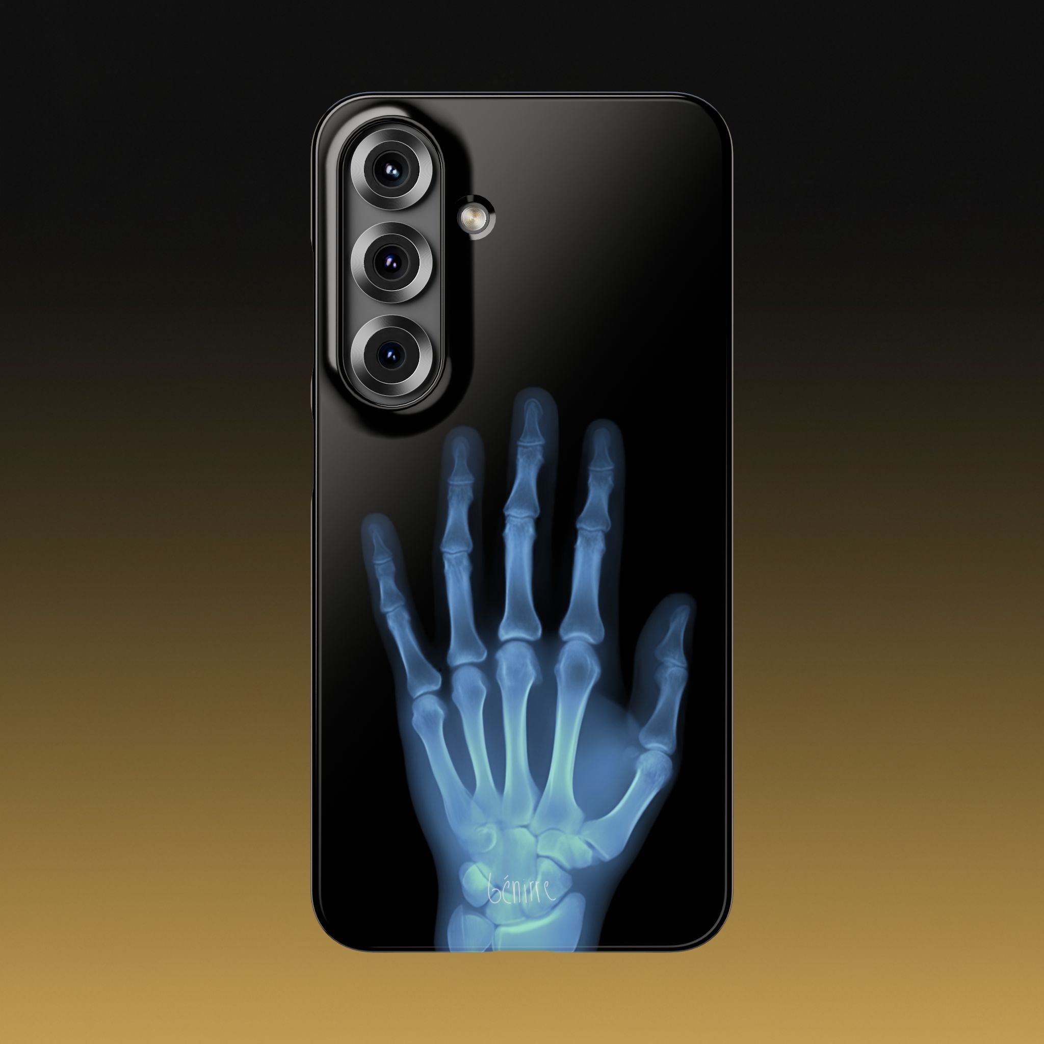 レントゲンライト