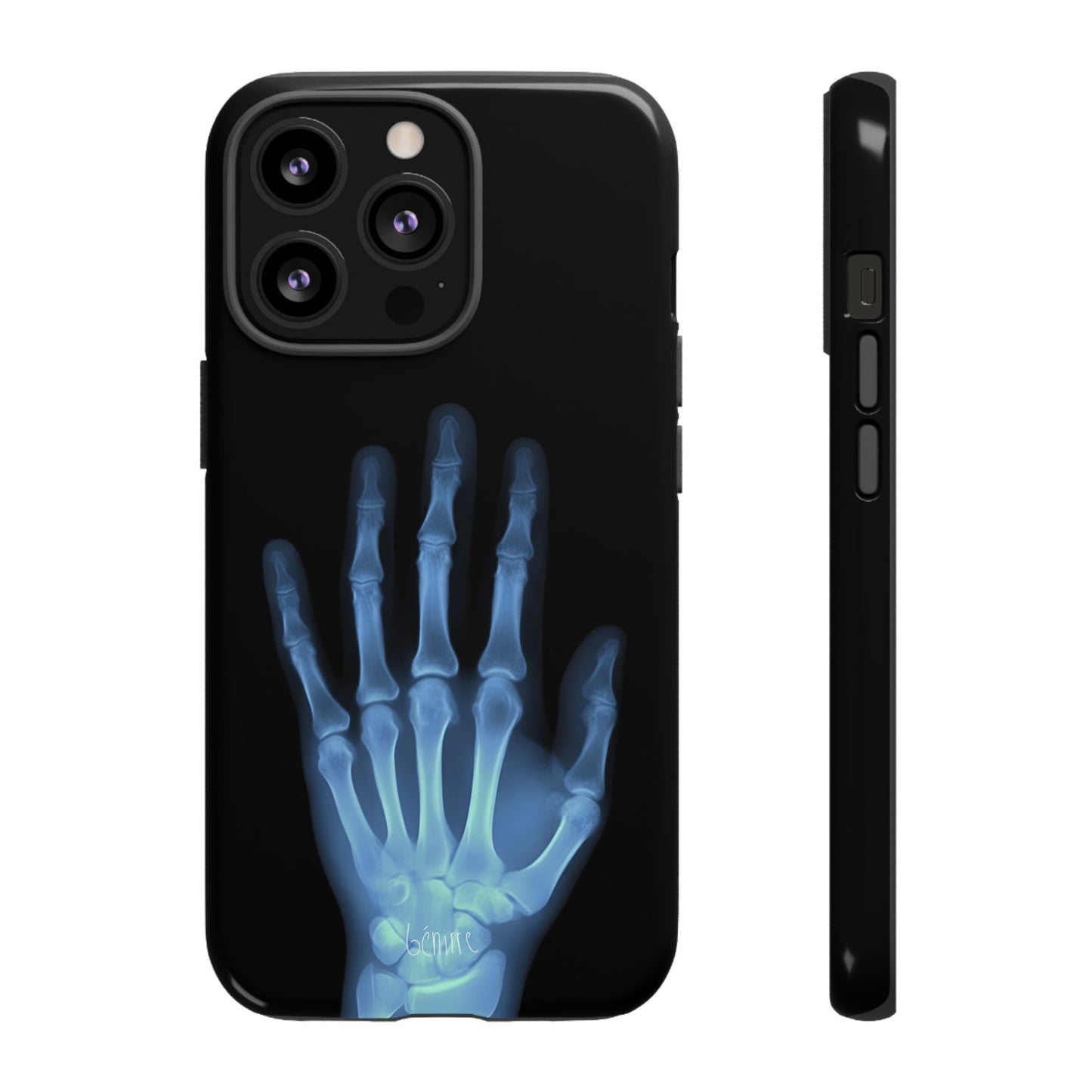 The Radiograph Tough Case