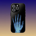 レントゲン写真