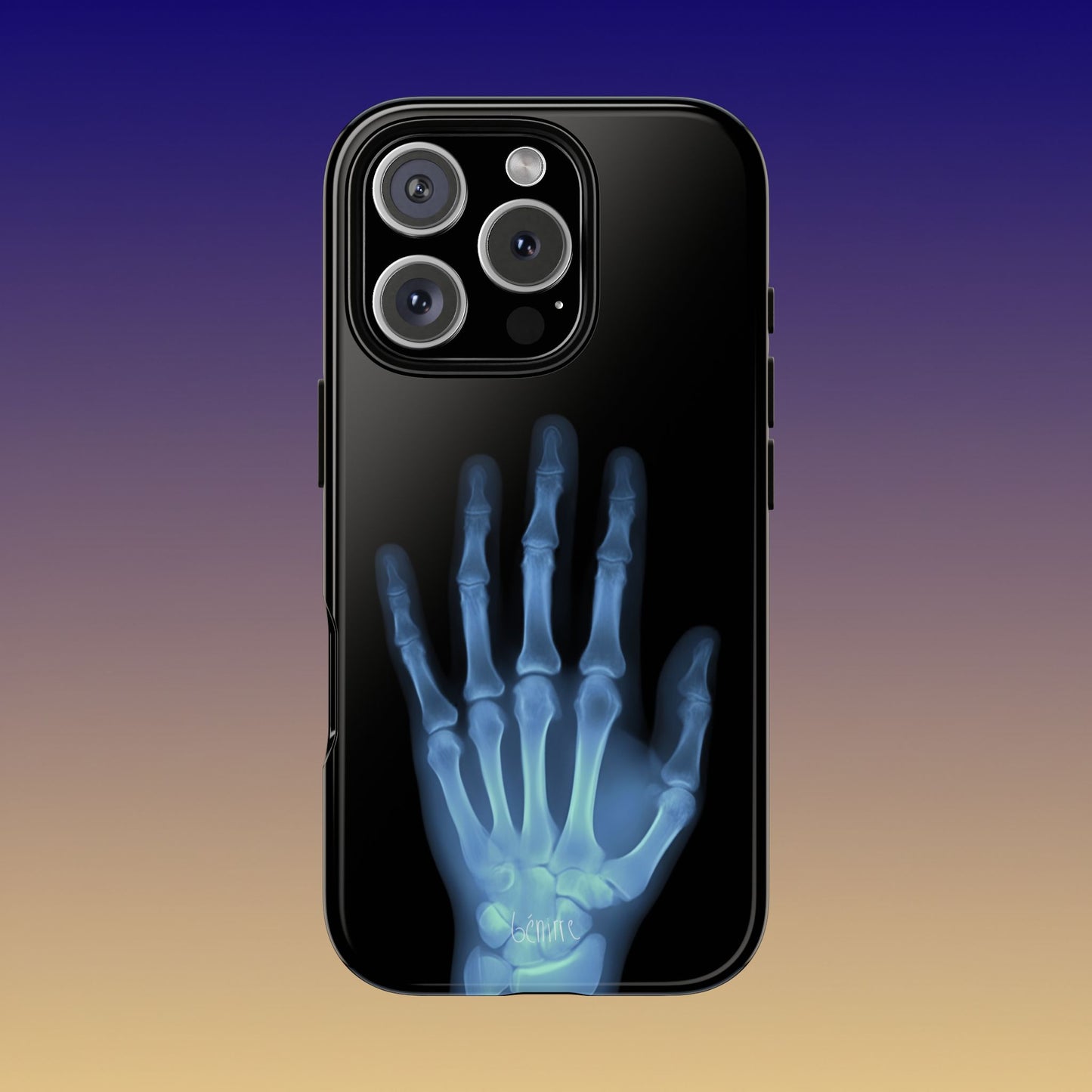 The Radiograph Tough Case