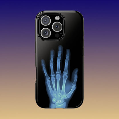 The Radiograph Tough Case