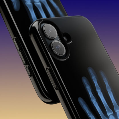 The Radiograph Tough Case