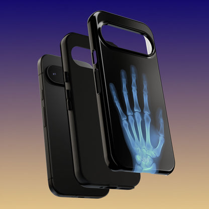 The Radiograph Tough Case